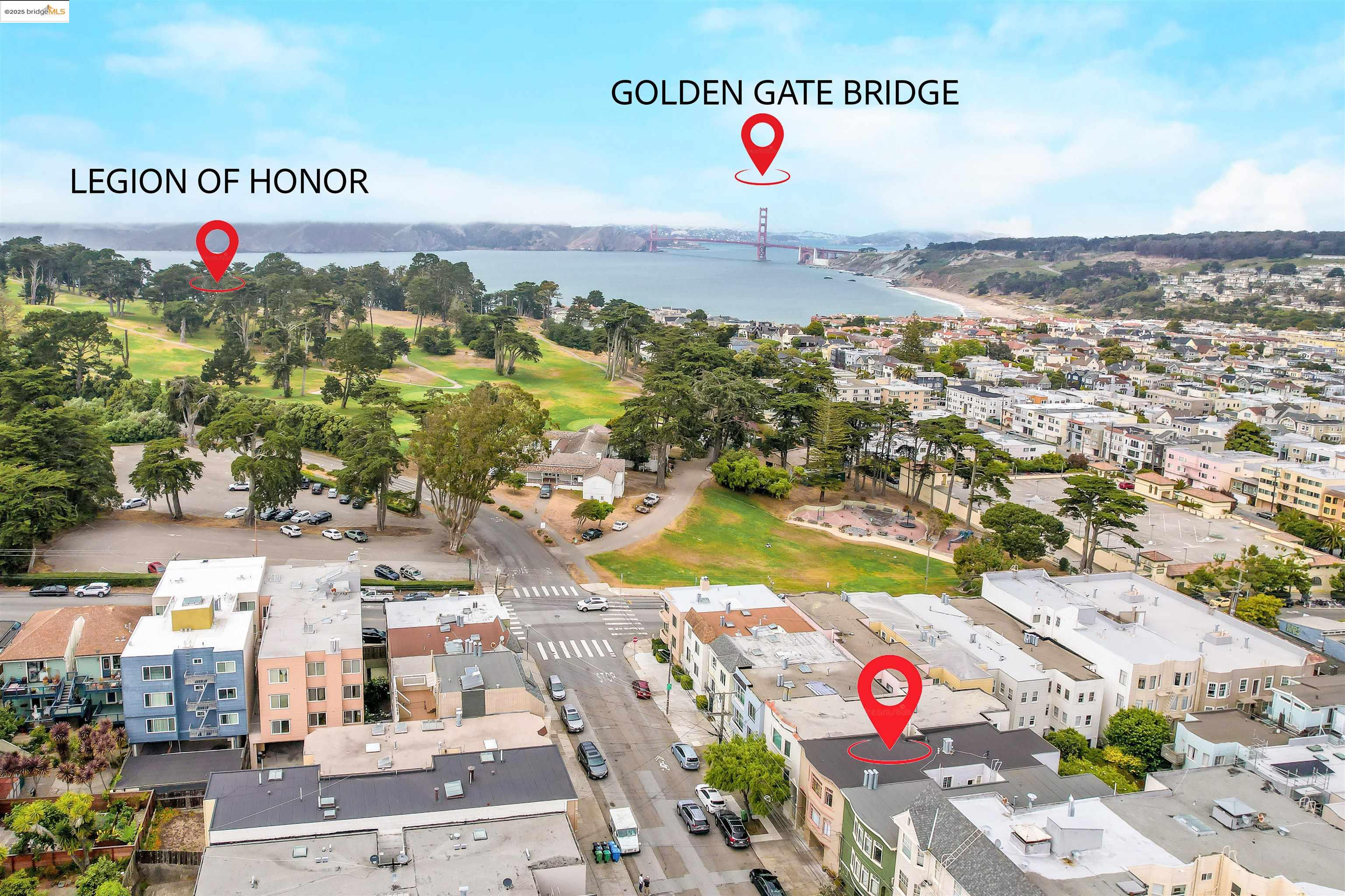 Detail Gallery Image 6 of 47 For 422-424 34th Ave, San Francisco,  CA 94121 - – Beds | – Baths