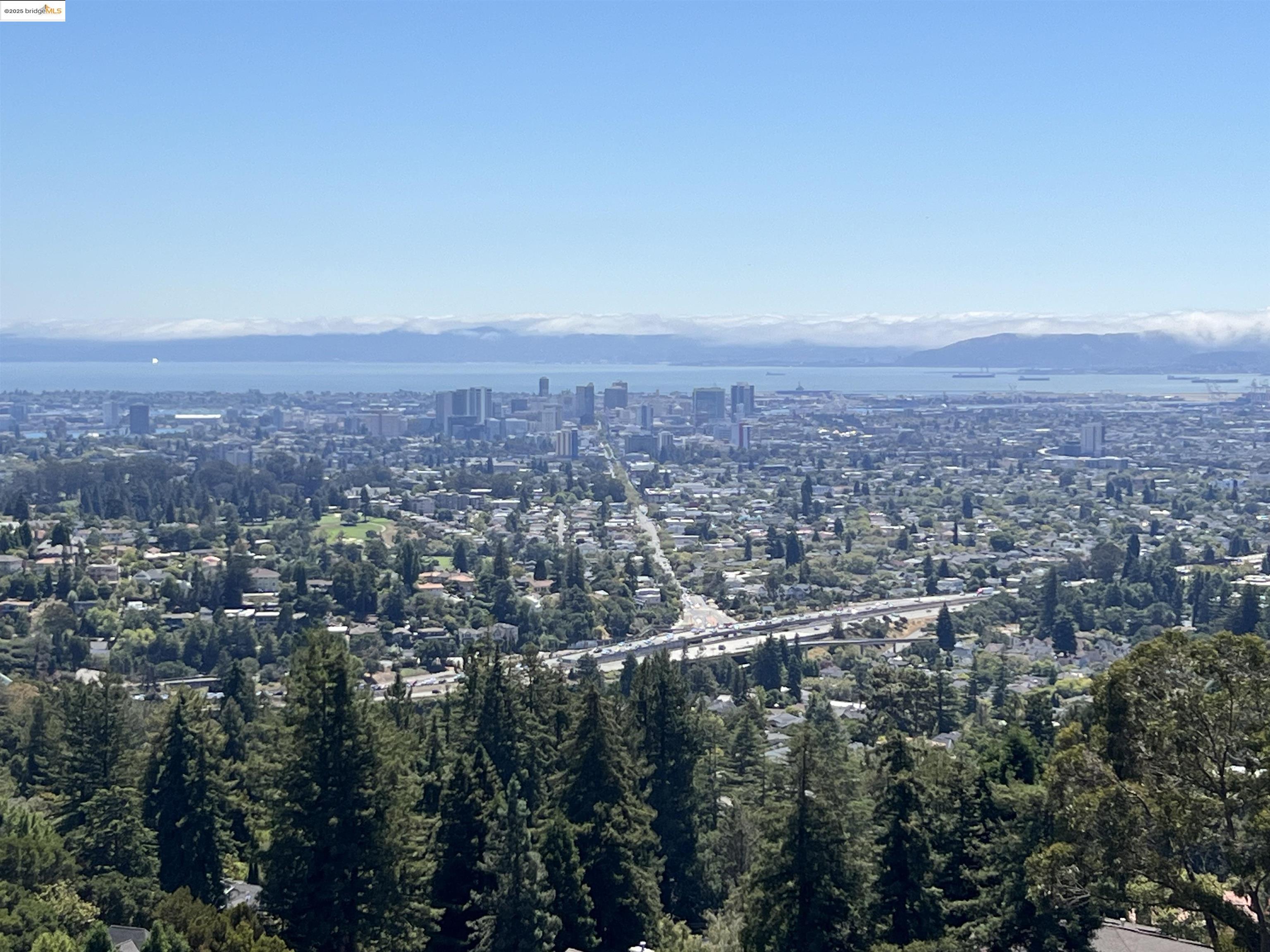 Detail Gallery Image 8 of 14 For 142 Gravatt Dr, Berkeley,  CA 94705 - – Beds | – Baths